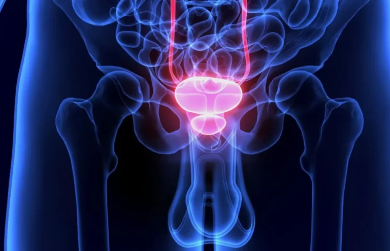 Cáncer de próstata: los 5 cambios en la orina que nos alertan de un tumor en crecimiento