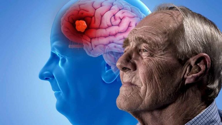 Una molécula que facilita recuperar la memoria estimula la búsqueda de una cura para el alzhéimer