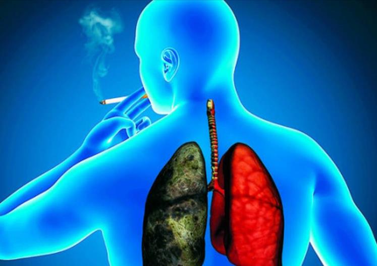 Por qué aparece el cáncer de pulmón en no fumadores